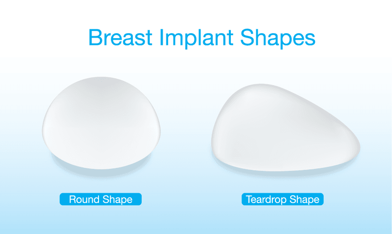 Types of Breast Implants - How do I pick? Types of Breast Implants - How do I pick?
